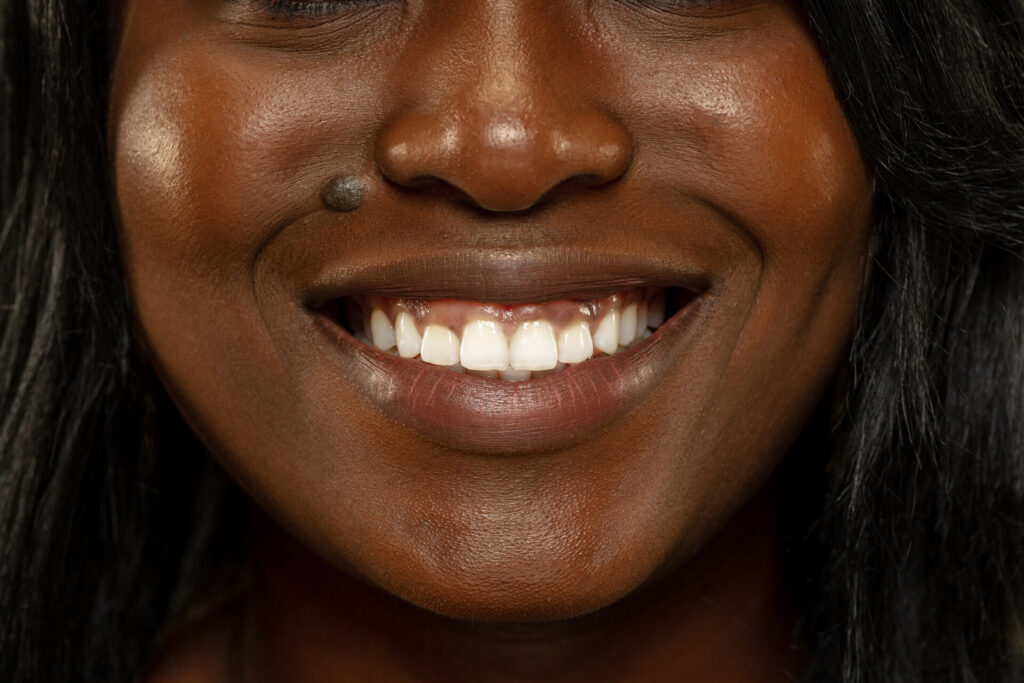 Porcelain-Veneers-in-Abuja

<a href="https://www.freepik.com/free-photo/young-african-american-woman-isolated-yellow-wall-facial-expression-beautiful-female-close-up-portrait-concept-human-emotions-facial-expression-smiling_10707766.htm#query=African%20Porcelain%20Veneers%20before%20and%20after&position=1&from_view=search&track=ais">Image by master1305</a> on Freepik