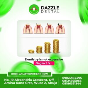 Read more about the article Root Canal Treatment at Dazzle Dental Clinic Abuja.