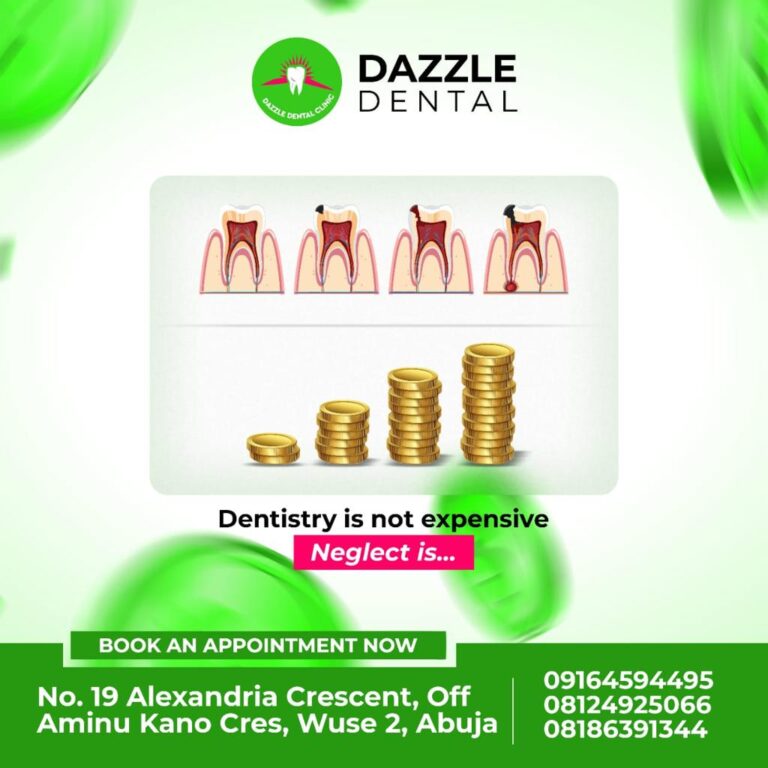 Read more about the article Root Canal Treatment at Dazzle Dental Clinic Abuja.