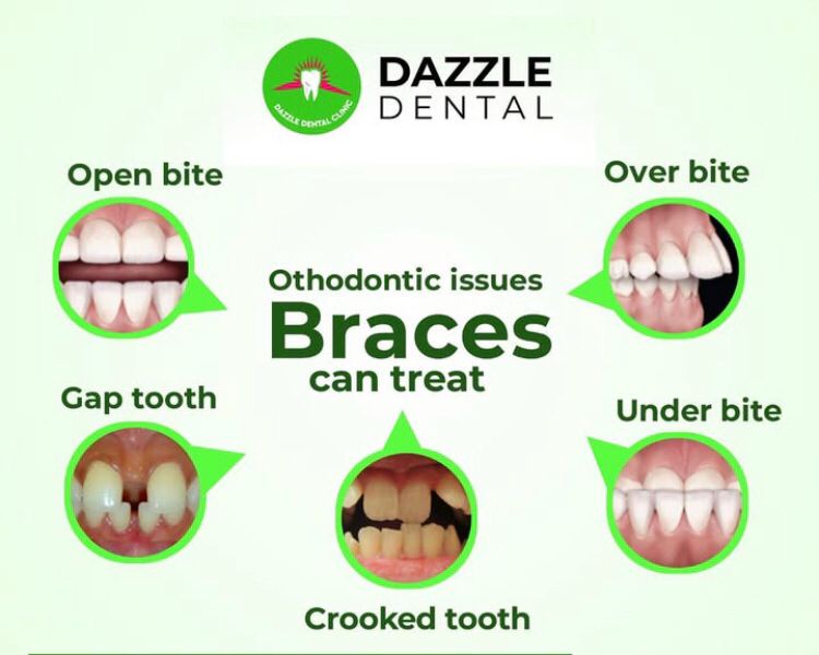 Read more about the article Top Benefits of Orthodontic Treatment: A Healthier, Straighter Smile